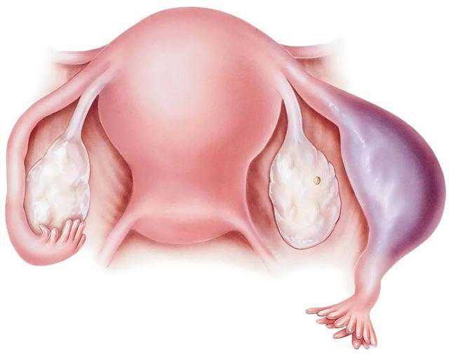 hcg最低多少放弃保胎？