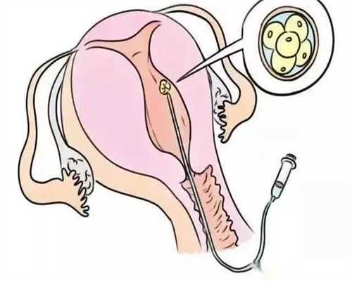 木瓜的籽能吃吗，木瓜的籽可以吃吗*三代代生机构